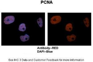 Immunohistochemistry (IHC) image for anti-Proliferating Cell Nuclear Antigen (PCNA) (C-Term) antibody (ABIN2792157)