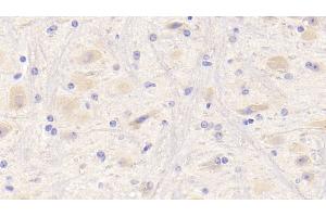 Detection of NRG1 in Mouse Cerebrum Tissue using Polyclonal Antibody to Neuregulin 1 (NRG1) (Neuregulin 1 抗体  (AA 54-163))