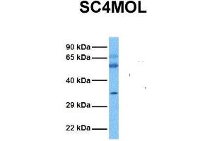 Host:  Rabbit  Target Name:  SC4MOL  Sample Tissue:  Human Ovary Tumor  Antibody Dilution:  1. (SC4MOL 抗体  (N-Term))