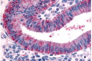 Human Uterus, Endometrium (formalin-fixed, paraffin-embedded) stained with DKK1 antibody ABIN213403 at 20 ug/ml followed by biotinylated goat anti-rabbit IgG secondary antibody ABIN481713, alkaline phosphatase-streptavidin and chromogen. (DKK1 抗体  (N-Term))