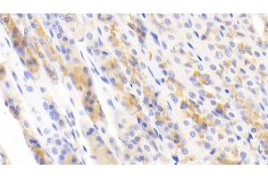 Detection of NFKB3 in Mouse Stomach Tissue using Polyclonal Antibody to Transcription Factor P65 (NFKB3) (NF-kB p65 抗体  (AA 19-306))