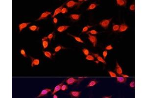 Immunofluorescence analysis of C6 cells using TriMethyl-Histone H3-K14 Polyclonal Antibody at dilution of 1:100 (40x lens). (Histone 3 抗体  (3meLys14))