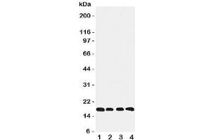 Western blot testing of Cyclophilin B antibody and Lane 1:  rat ovary;  2: HeLa;  3: 293T;  4: A431 cell lysate (PPIB 抗体  (C-Term))