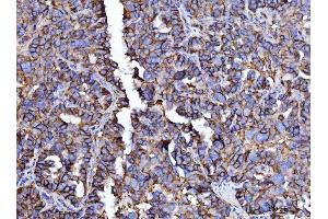 IHC analysis of CD147/Emmprin using anti-CD147/Emmprin antibody (ABIN7599997). (CD147 抗体  (AA 138-323))