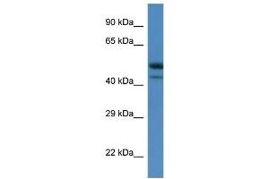 WB Suggested Anti-Sbk1 Antibody   Titration: 1. (SBK1 抗体  (C-Term))