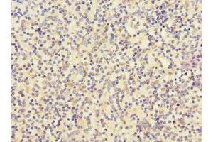 Immunohistochemistry of paraffin-embedded human spleen tissue using ABIN7147132 at dilution of 1:100 (Integrin beta 2 抗体  (AA 24-220))