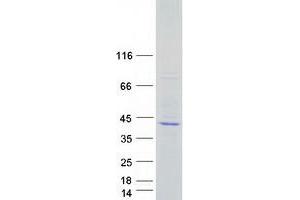 Western Blotting (WB) image for Secretory Carrier Membrane Protein 2 (SCAMP2) protein (Myc-DYKDDDDK Tag) (ABIN2731436)