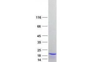 Western Blotting (WB) image for Nuclear Cap Binding Protein Subunit 2 (NCBP2) (Transcript Variant 2) protein (Myc-DYKDDDDK Tag) (ABIN2726877)