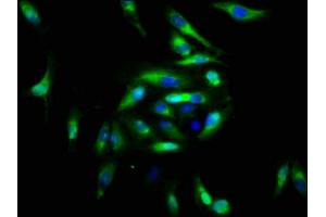 Immunofluorescence staining of Hela cells with ABIN7152853 at 1:166, counter-stained with DAPI. (FGFRL1 抗体  (AA 403-470))