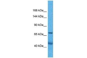 Host:  Rabbit  Target Name:  ZNF606  Sample Type:  Lung Tumor lysates  Antibody Dilution:  1. (ZNF606 抗体  (Middle Region))