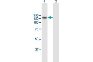 Western Blot analysis of ADAR expression in transfected 293T cell line by ADAR MaxPab polyclonal antibody. (ADAR 抗体  (AA 1-1226))