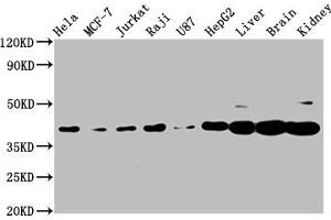 Western Blot Positive WB detected in: Hela whole cell lysate, MCF-7 whole cell lysate, Jurkat whole cell lysate, Raji whole cell lysate, U87 whole cell lysate, HepG2 whole cell lysate, Rat liver tissue, Mouse brain tissue, Mouse kidney tissue All lanes: PNCK antibody at 3. (PNCK 抗体  (AA 1-115))