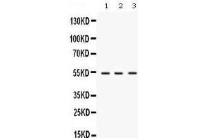 Western blot analysis of SPTLC1 expression in rat brain extract (lane 1), mouse brain extract (lane 2) and MCF-7 whole cell lysates (lane 3). (SPTLC1 抗体  (C-Term))