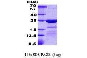 Figure annotation denotes ug of protein loaded and % gel used. (HN1L 蛋白)