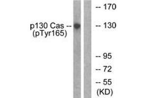 Western blot analysis of extracts from HepG2 cells treated with EGF 200ng/ml 30', using p130 Cas (Phospho-Tyr165) Antibody. (BCAR1 抗体  (pTyr165))