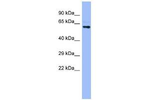 CYP4A22 antibody used at 1 ug/ml to detect target protein. (CYP4A22 抗体  (N-Term))