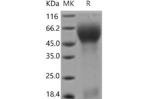 Western Blotting (WB) image for Prominin 1 (PROM1) protein (His tag) (ABIN7321128) (CD133 Protein (His tag))