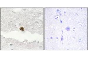 Immunohistochemistry analysis of paraffin-embedded human brain, using DGKZ Antibody. (DGKZ 抗体  (AA 601-650))