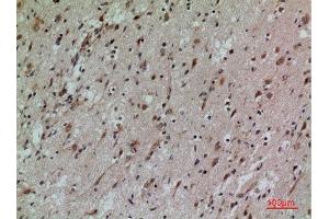 Immunohistochemistry (IHC) analysis of paraffin-embedded Human Brain, antibody was diluted at 1:100. (CD58 抗体  (Internal Region))