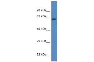 Western Blot showing ACSF2 antibody used at a concentration of 1 ug/ml against Fetal Lung Lysate (ACSF2 抗体  (C-Term))