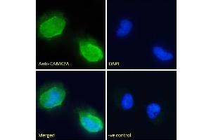 (ABIN570984) Immunofluorescence analysis of paraformaldehyde fixed U251 cells, permeabilized with 0. (CaMKII alpha/beta (Internal Region) 抗体)