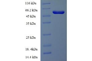 SDS-PAGE (SDS) image for Integrin-Linked Kinase-Associated Serine/threonine Phosphatase 2C (ILKAP) (AA 1-392), (full length) protein (His-SUMO Tag) (ABIN5709757) (ILKAP Protein (AA 1-392, full length) (His-SUMO Tag))