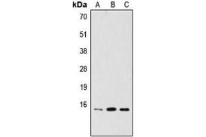 Western blot analysis of PDRG1 expression in HeLa (A), MCF7 (B), A2058 (C) whole cell lysates. (PDRG1 抗体  (Center))