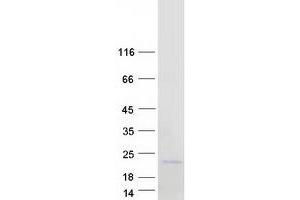 Western Blotting (WB) image for Nanos Homolog 2 (NANOS2) protein (Myc-DYKDDDDK Tag) (ABIN2726790)