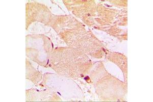 Immunohistochemical analysis of Dysferlin staining in human muscle formalin fixed paraffin embedded tissue section. (Dysferlin 抗体  (C-Term))