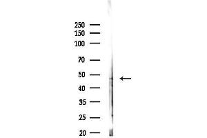 Western blot analysis of lysates from 3-L1 cells(heat-shock,45 min treatment), using CHS Antibody at 1/1000 dilution.