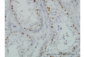 Immunoperoxidase of monoclonal antibody to SALL4 on formalin-fixed paraffin-embedded human testis. (SALL4 抗体  (AA 954-1053))