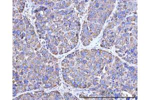 IHC analysis of RPN1 using anti-RPN1 antibody (ABIN7600447). (RPN1 抗体  (AA 196-495))