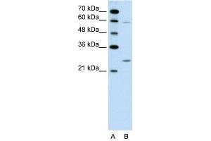 GAMT antibody used at 0. (GAMT 抗体  (N-Term))