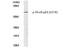 Image no. 1 for anti-Nuclear Factor-kB p65 (NFkBP65) (pSer276) antibody (ABIN318082) (NF-kB p65 抗体  (pSer276))