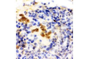 Anti-FLI1 antibody, IHC(P) IHC(P): Rat Spleen Tissue (FLI1 抗体  (N-Term))