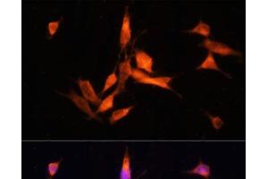 Immunofluorescence analysis of NIH-3T3 cells using MMP10 Polyclonal Antibody at dilution of 1:100 (40x lens). (MMP10 抗体)