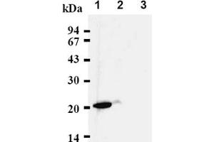 Western Blotting (WB) image for anti-Cyclin-Dependent Kinase Inhibitor 1A (p21, Cip1) (CDKN1A) antibody (ABIN487485) (p21 抗体)