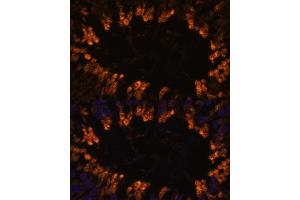 Immunofluorescence analysis of rat testis using OXCT2 antibody (ABIN7265333) at dilution of 1:100. (OXCT2 抗体  (AA 430-510))