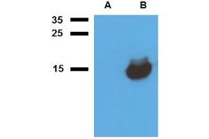 Western blot analysis of polyclonal anti-Mycobacterium tuberculosis antigen Acr1. (HspX 抗体)