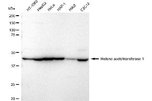 Western blotting analysis using Histone acetyltransferase 1 antibody (ABIN7798921).