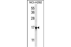 Western blot analysis in NCI-H292 cell line lysates (35ug/lane). (PAGE5 抗体  (C-Term))