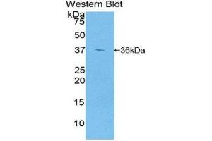 Western Blotting (WB) image for anti-Glutamate Decarboxylase 2 (Pancreatic Islets and Brain, 65kDa) (GAD2) (AA 65-105) antibody (ABIN1858941) (GAD65 抗体  (AA 65-105))
