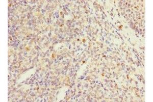 Immunohistochemistry of paraffin-embedded human tonsil tissue using ABIN7174120 at dilution of 1:100 (PTPN7 抗体  (AA 1-190))