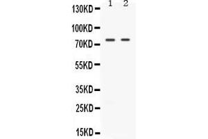 Western blot analysis of TAK1 expression in rat spleen extract ( Lane 1) and HELA whole cell lysates ( Lane 2). (MAP3K7 抗体  (C-Term))