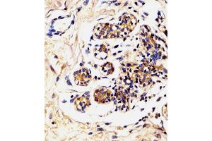 Antibody staining LALBA in Human breast tissue sections by Immunohistochemistry (IHC-P - paraformaldehyde-fixed, paraffin-embedded sections). (LALBA 抗体  (AA 39-68))