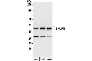 anti-Snurportin 1 (SNUPN) (AA 310-360) antibody