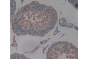 IHC-P analysis of Human Tissue, with DAB staining. (DNAH11 抗体  (AA 17-299))