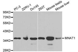 Western blot analysis of extracts of various cell lines, using MNAT1 antibody. (MNAT1 抗体  (AA 1-309))
