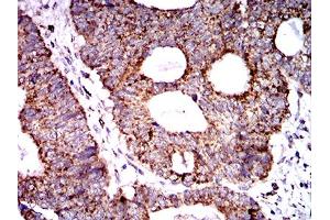 Immunohistochemistry (IHC) image for anti-Superoxide Dismutase 2, Mitochondrial (SOD2) (AA 1-222) antibody (ABIN5888812) (SOD2 抗体  (AA 1-222))