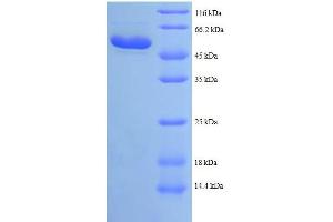 HADHB Protein (AA 35-283, partial) (GST tag)